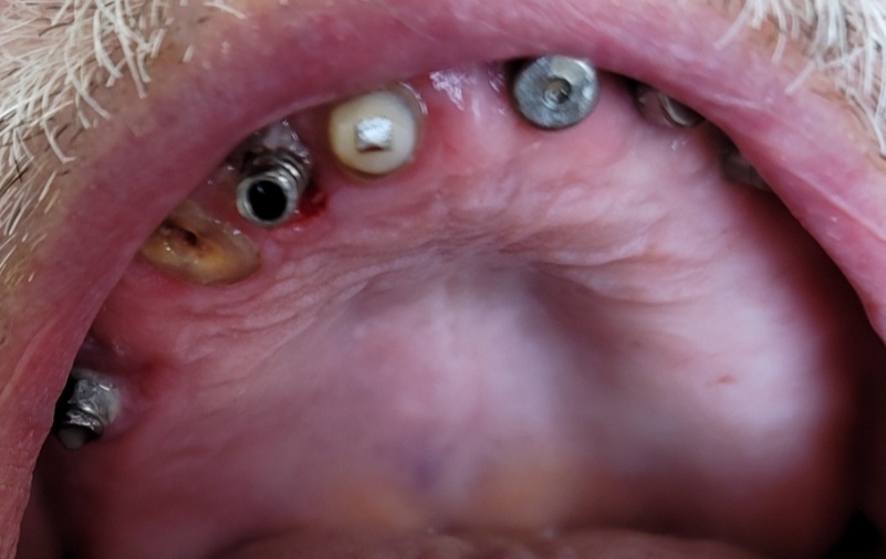 Screenshot_20220117-172639_Gallery