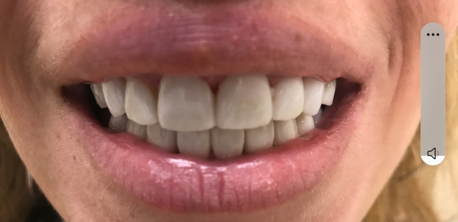 Screenshot_20220117-172941_Gallery