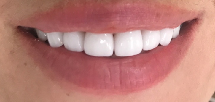 Screenshot_20220117-173003_Gallery