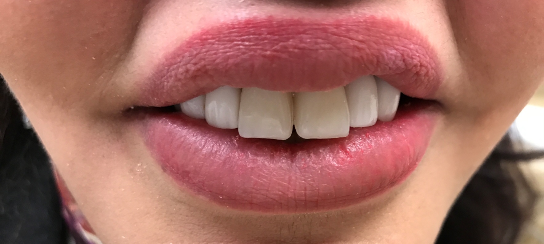 Screenshot_20220117-173103_Gallery