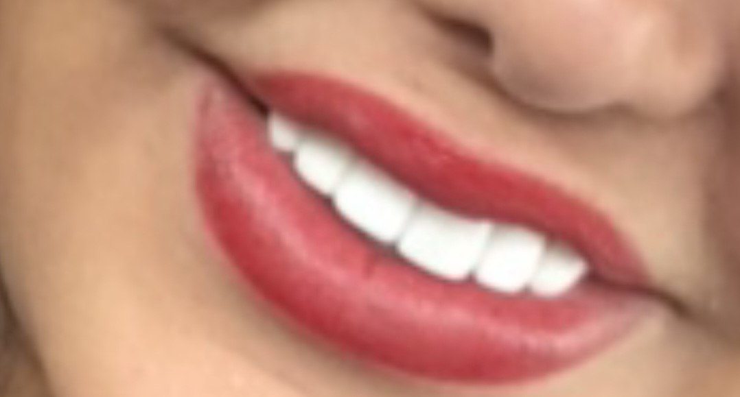 Screenshot_20220117-173131_Gallery